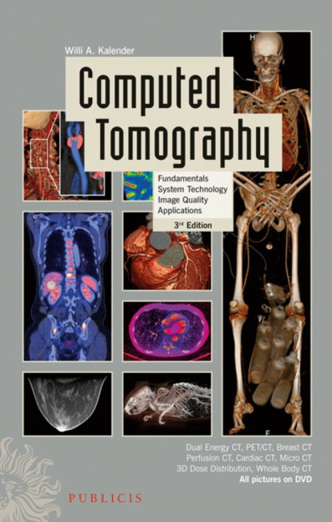 Computed Tomography Fundamentals System Technology Image Quality Applications