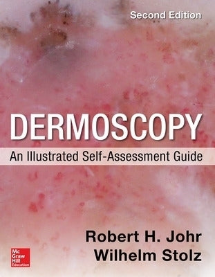 Dermoscopy an Illustrated Self Assessment Guide