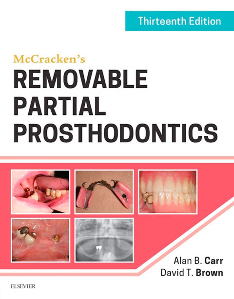 Mccrackens Removable Partial Prosthodontics