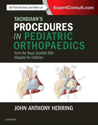 Tachdjians Procedures in Pediatric Orthopaedics From the Texas Scottish Rite Hospital for Children