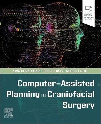 Computer Assisted Planning in Craniofacial Surgery