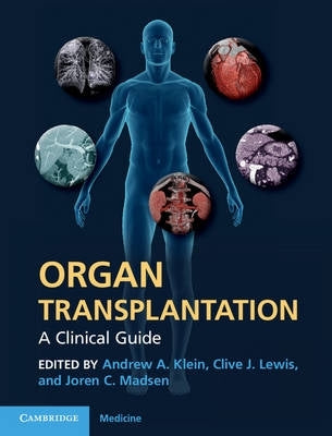 Organ Transplantation a Clinical Guide