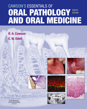 Cawsons Essentials of Oral Pathology and Oral Medicine E-Book