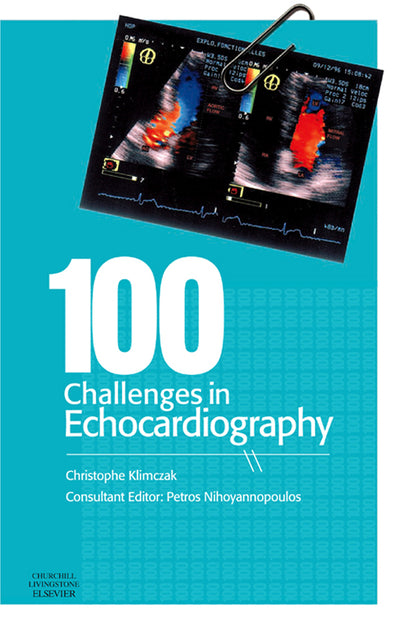 100 Challenges in Echocardiography E-Book