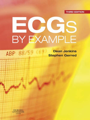 Ecgs by Example E-Book