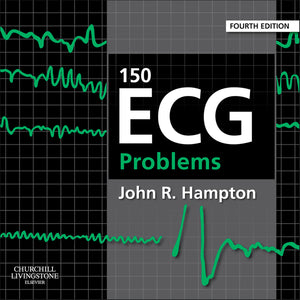 150 Ecg Problems E-Book