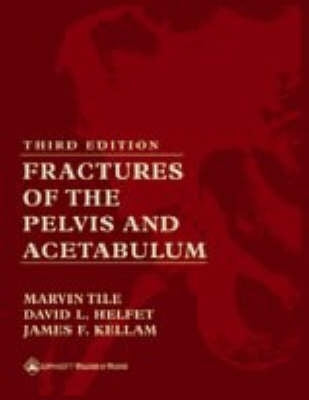Fractures of the Pelvis and Acetabulum