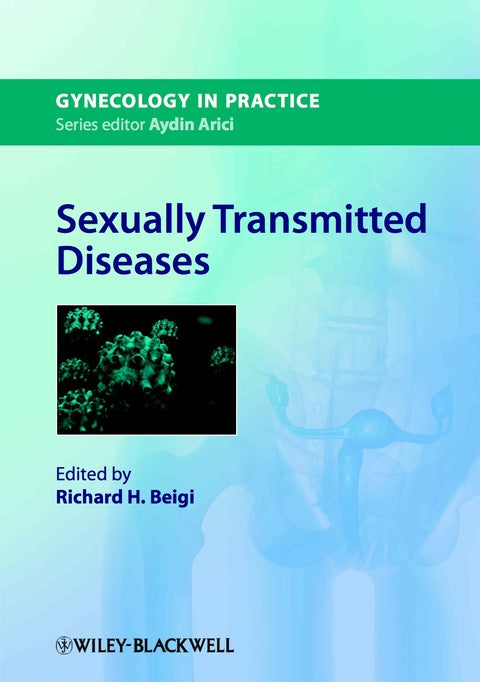 Sexually Transmitted Diseases