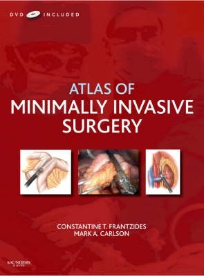 Atlas of Minimally Invasive Surgery (H/C) (Dvd Inlcluded)