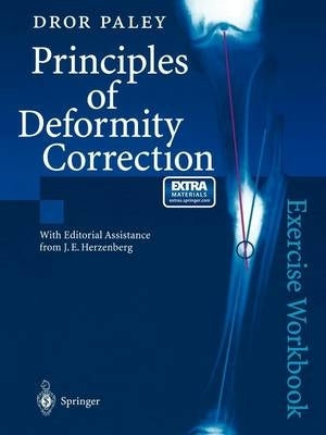Principles of Deformity Correction (Workbook)